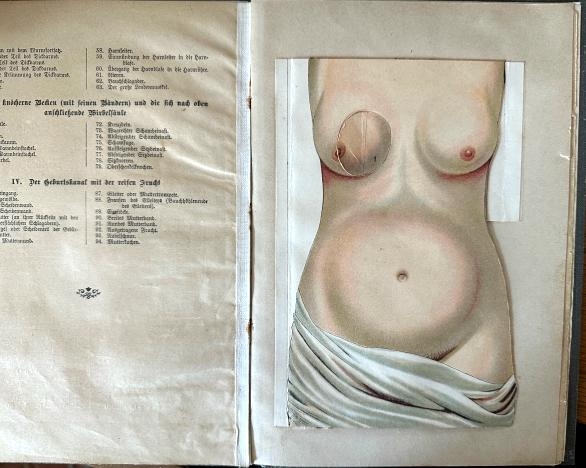 Bild von Objekt 81